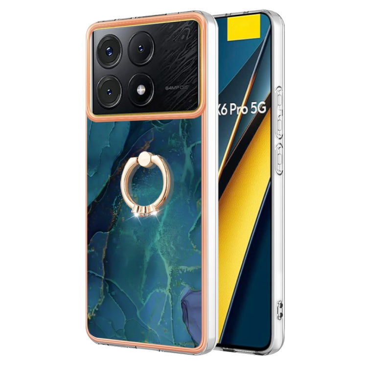 Electroplating Marble Dual-side IMD Phone Case with Ring