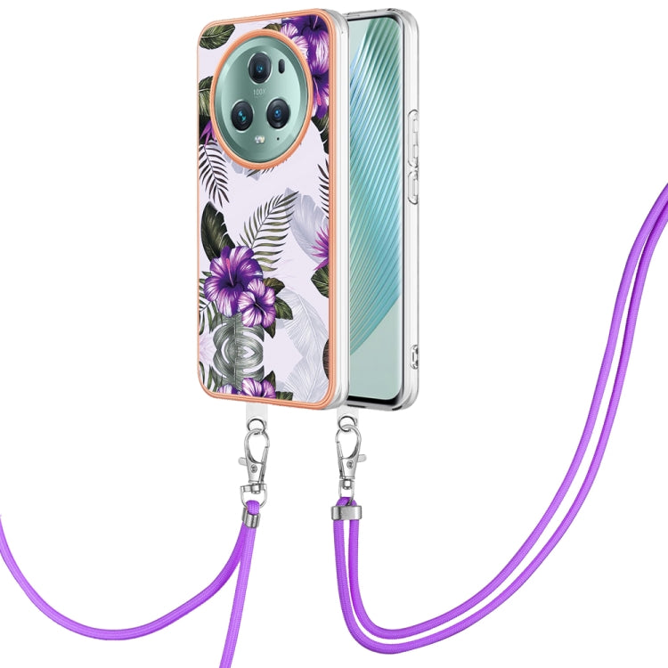Electroplating IMD TPU Phone Case with Lanyard